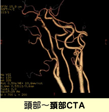 CT装置｜放射線科