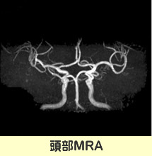 MRI装置｜放射線科
